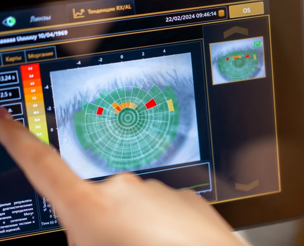 Benefits-of-Corneal-Topography